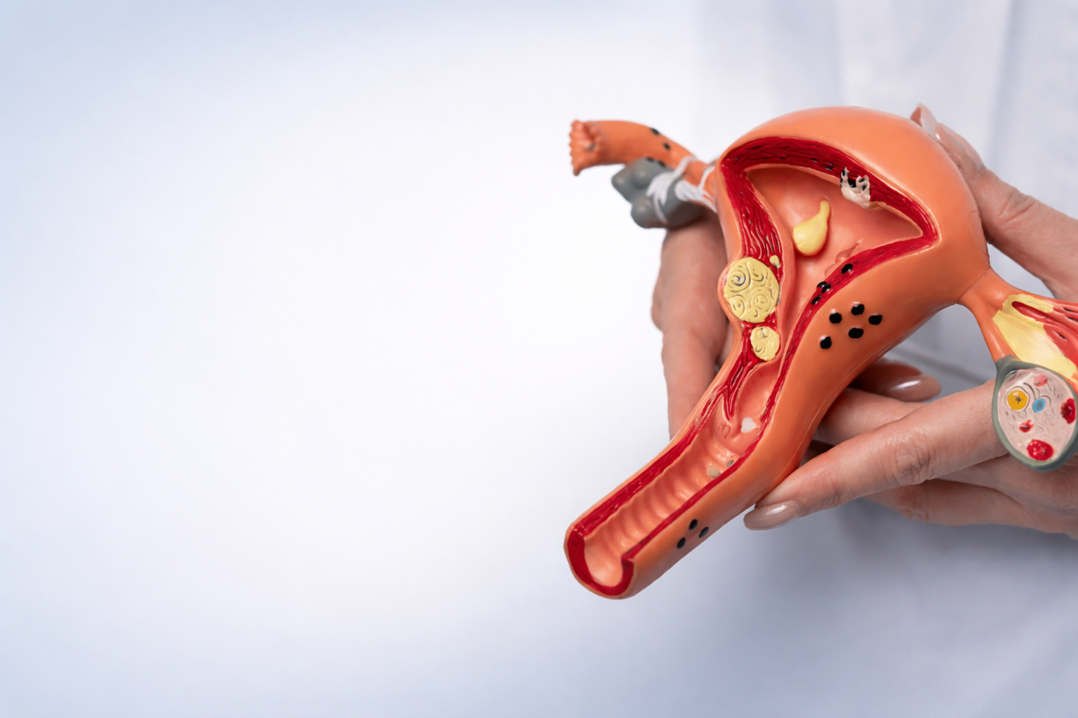 PCOS PCOD Infertility Care in Gangavathi – Advanced women's fertility and hormonal treatment at Yashodha Hospital