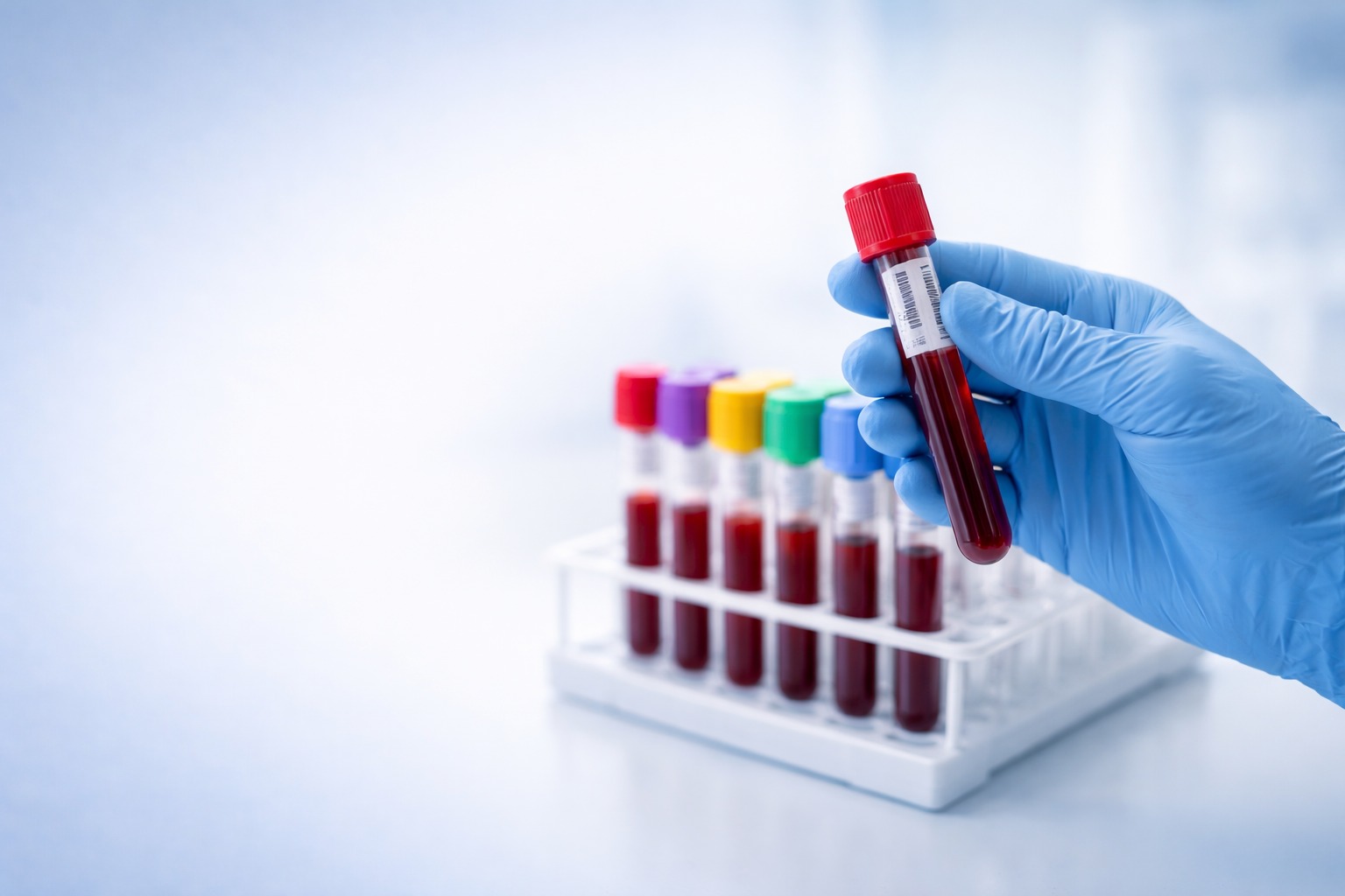 Laboratory Services in Gangavathi – Advanced diagnostic laboratory testing at Yashodha Hospital